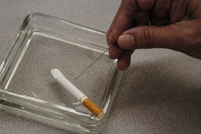 Acupuncture is one method area residents have used to eliminate their addiction to cigarettes. In this method, needles thinner than the one above are used at designated points in the smoker's body.<br>dailystandard.com
